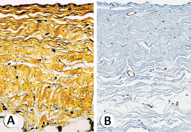 Fibrous (parietal) pericardim histology 1